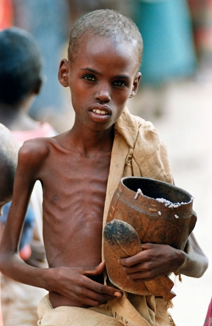 famine_enfant_somalien