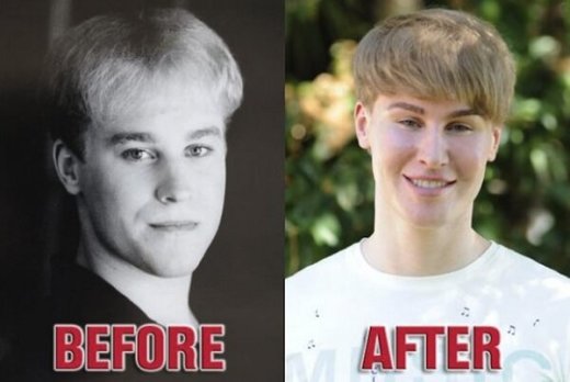 xjustin-bieber-fan-plastic-surgery.jpg.pagespeed.ic.SWZVVsAgMi