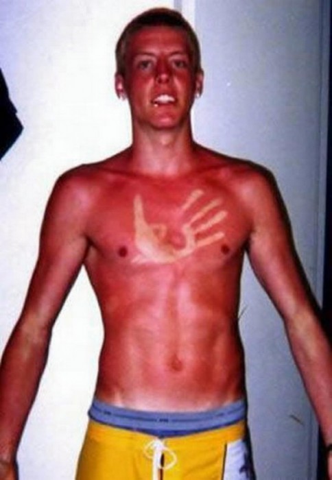 bronzage-fail-20-545x788