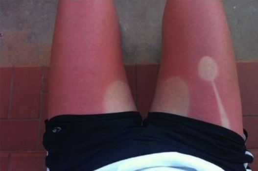 bronzage-fail-9