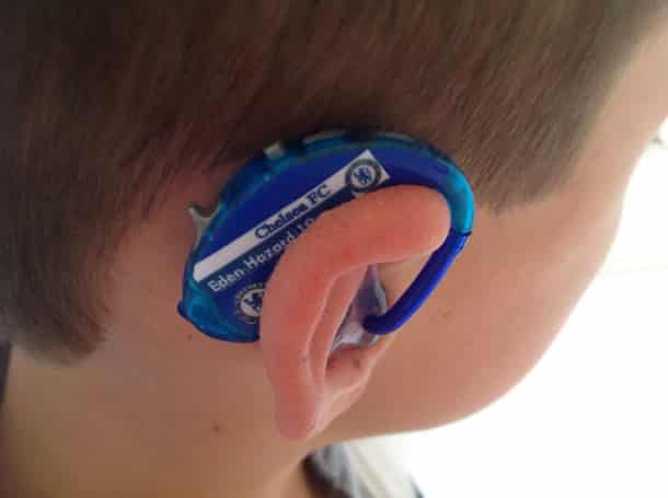 hearing-aid-decorations-kids-cochlear-implant-sarah-ivermee-lugs-1