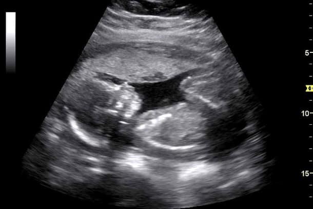 Image de photo de grossesse personnalisée par échographie pour bébé