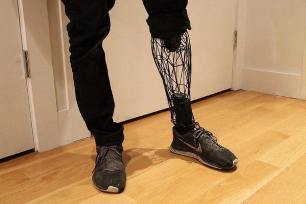 prothèses imprimées en 3D