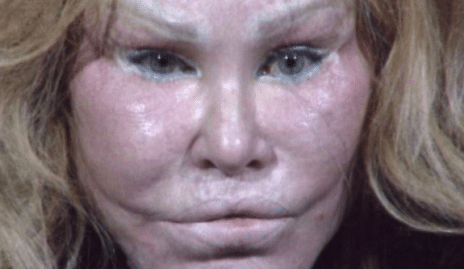 femme chat, Jocelyn Wildenstein, argent, dettes, chirurgie