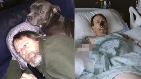 homme léché par un chien bactérie amputé