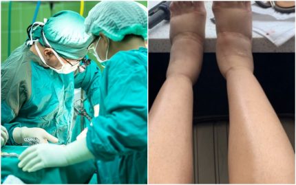 cardi b chirurgie esthétique