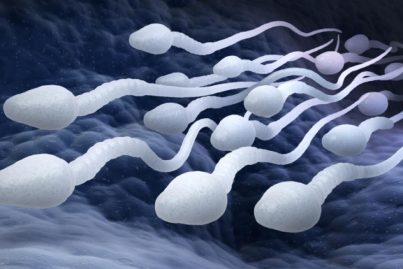 spermatoizoide