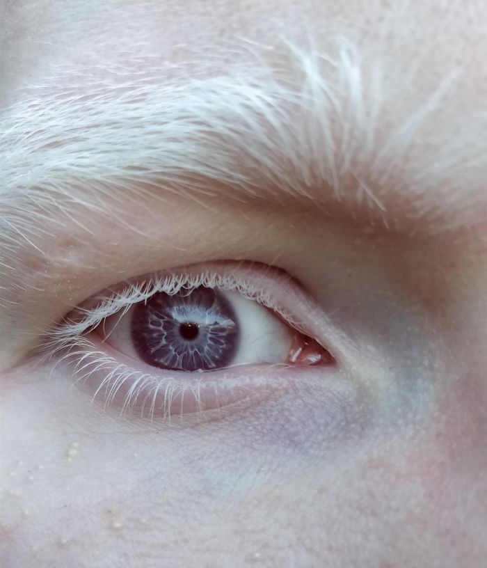 are purple eyes possible