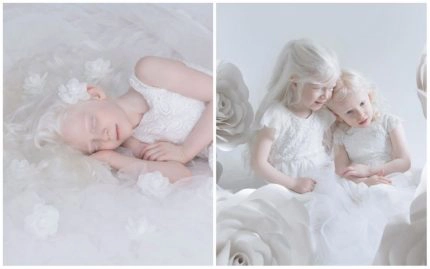Une photographe décide de mettre les albinos à l'honneur dans un shooting photo