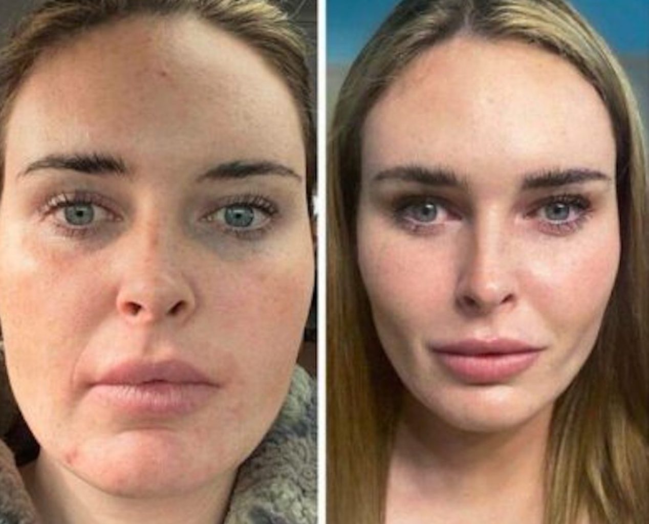 Supermaryface Plastic Surgery