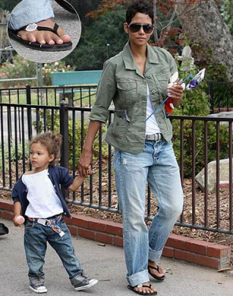 Halle Berry malformation