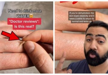 astuce-medecin-deshydratation-video-tiktok
