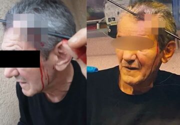 un homme se fait transpercer la tête par une flèche