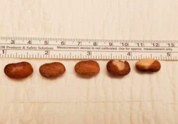 Plaisir sexuel : Il s'insère des haricots rouges dans le pénis et finit à l'hôpital