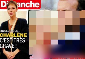 charlene squelettique