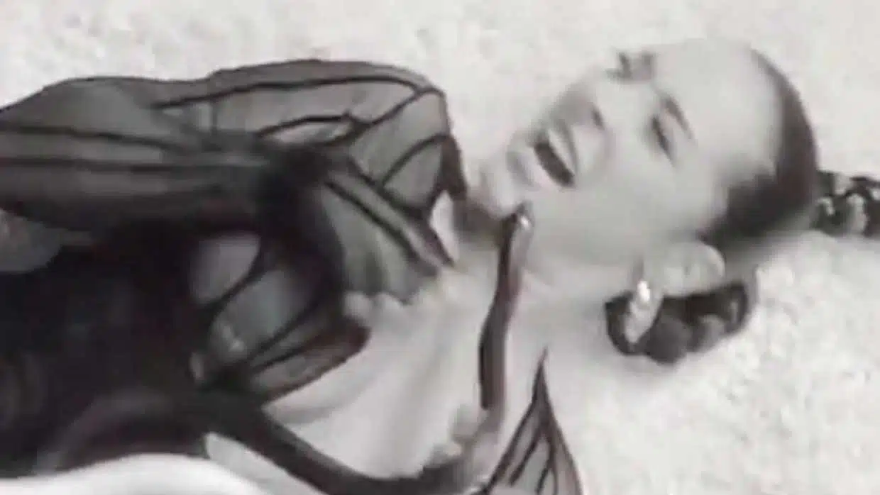 chanteuse mordue au visage par un serpent