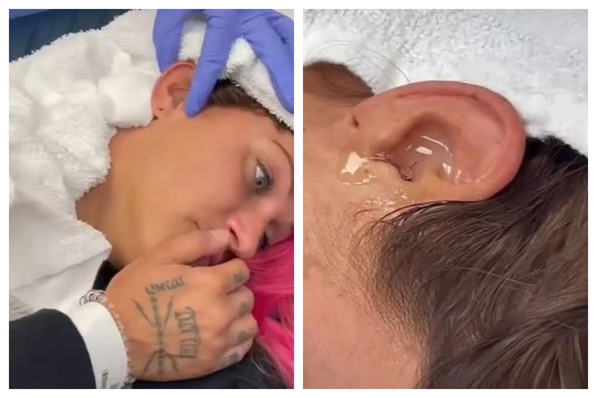 Elle se fait retirer un cafard coincé dans son oreille...