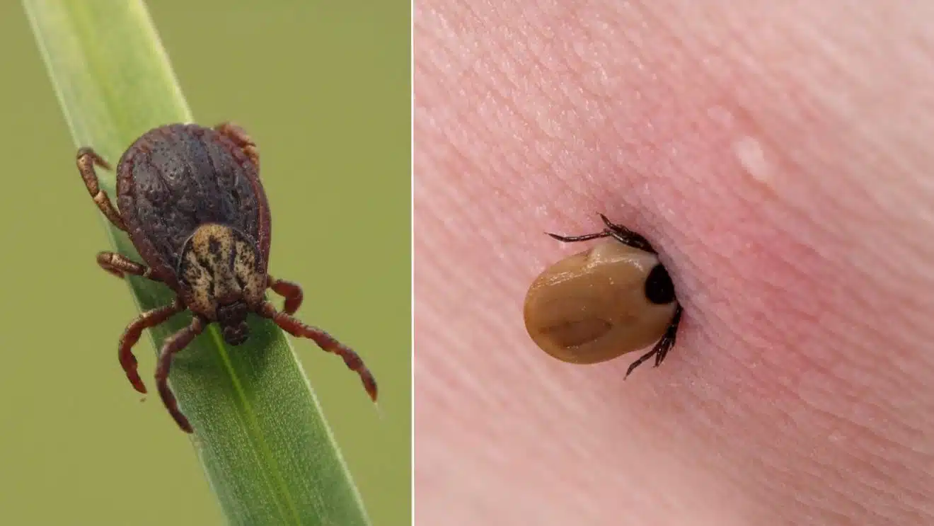 tique insecte maladie été france santé piqure