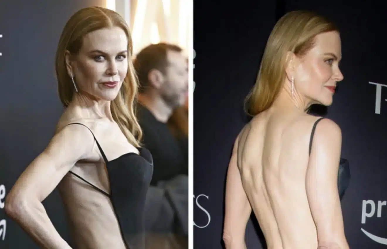 nicole kidman