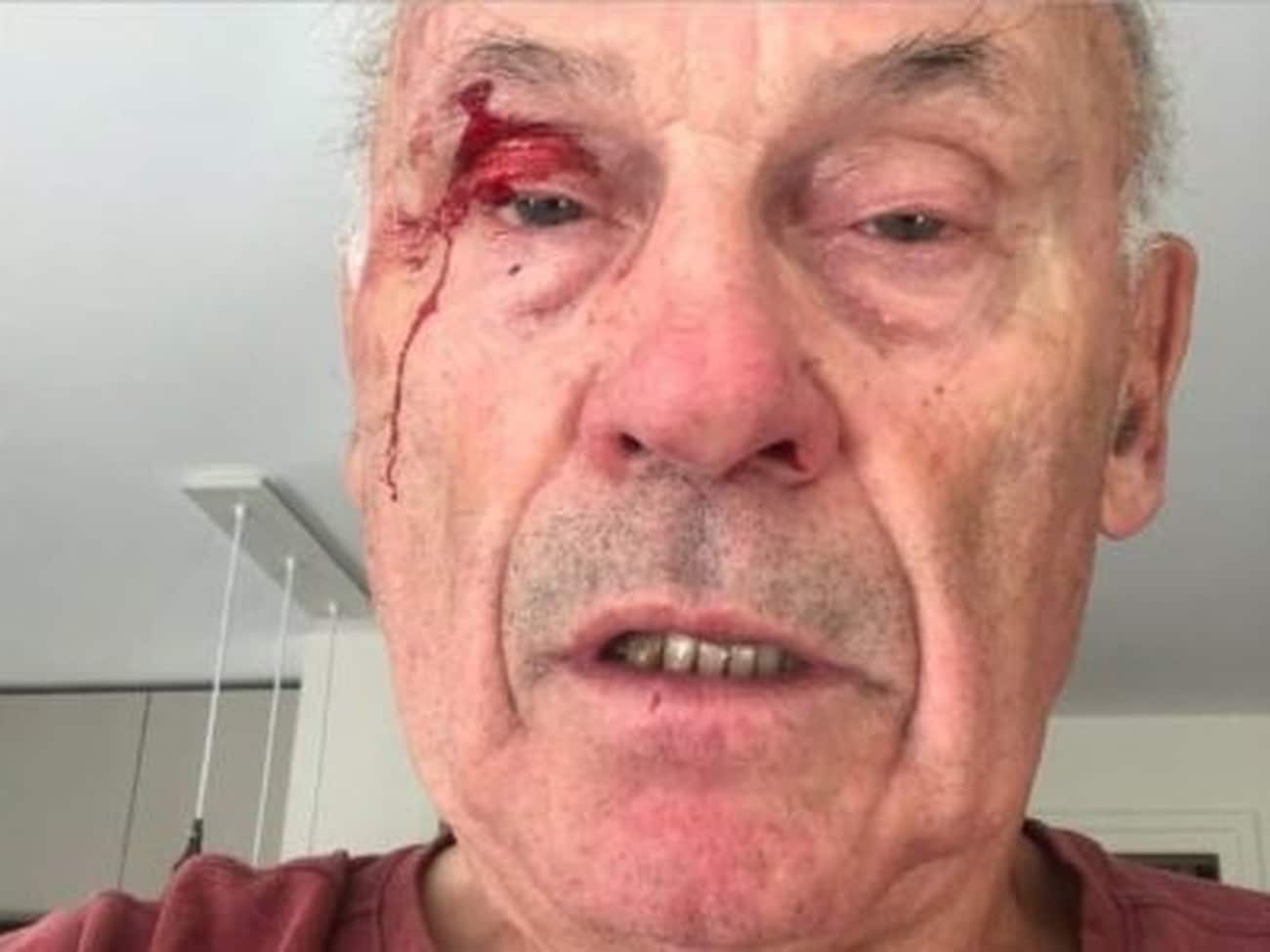 Bernard Dupré, 77 ans, agressé à La Tronche