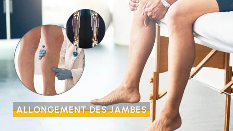 Chirurgie allongement jambes