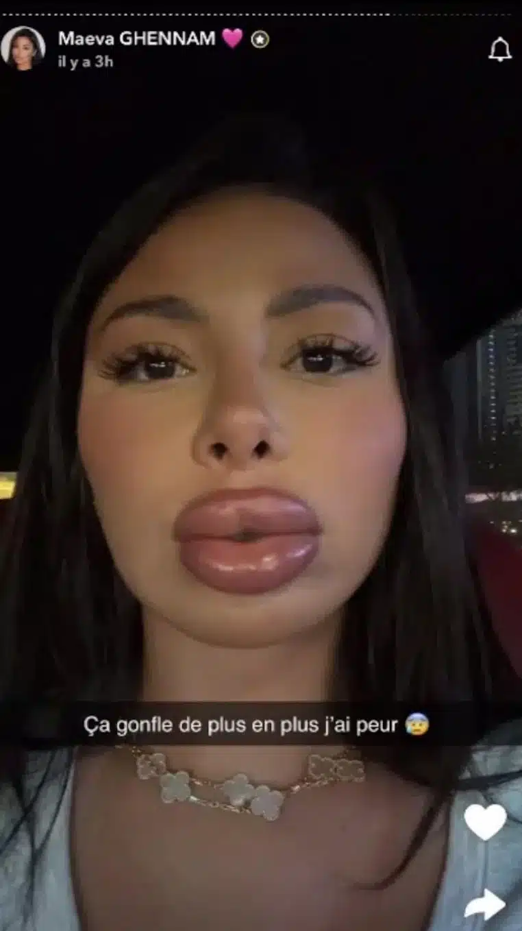 allergie instagram maeva ghennamm