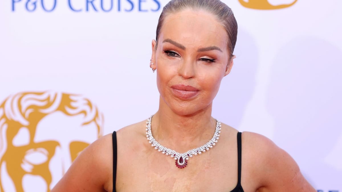 Katie Piper Agression