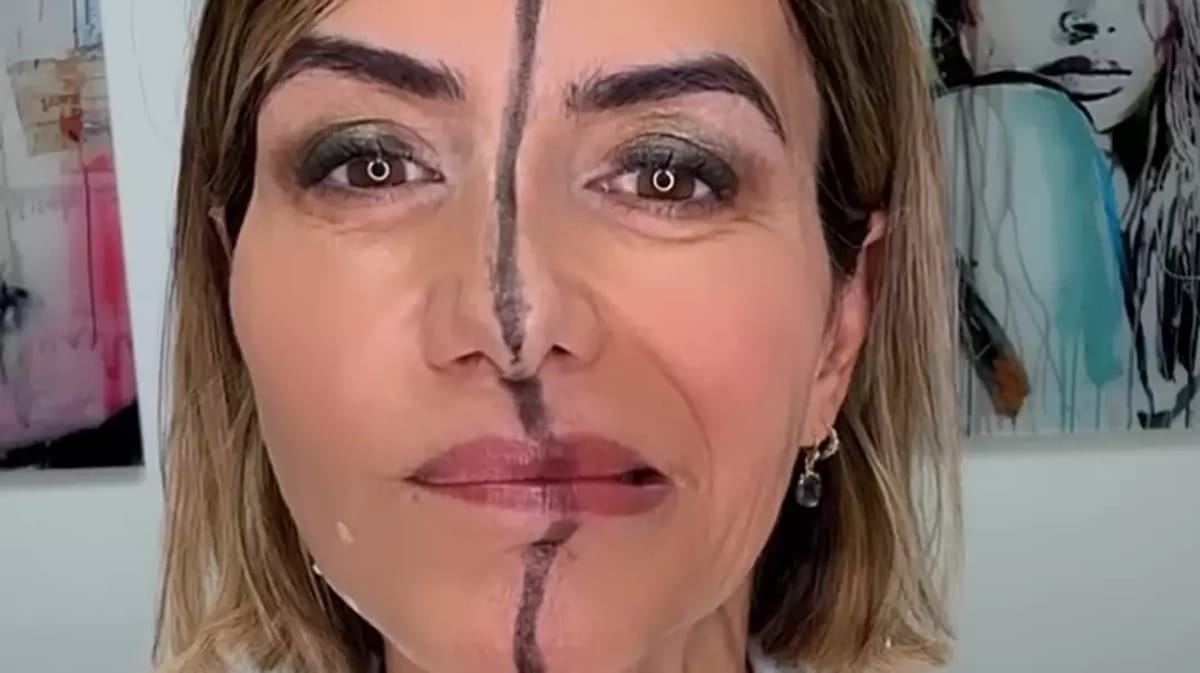Medecin effets botox